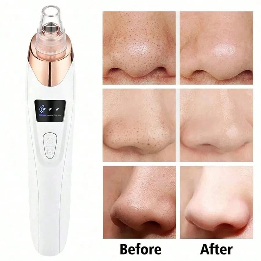 5-in-1 Blackhead Remover Vacuum — order online with COD in Pakistan